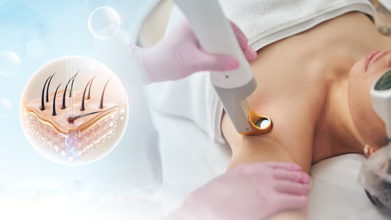 Triệt lông vùng kín Nam & Nữ hiệu quả – Địa điểm uy tín tại TP. HCM đặc biệt tại Gentle Waxing